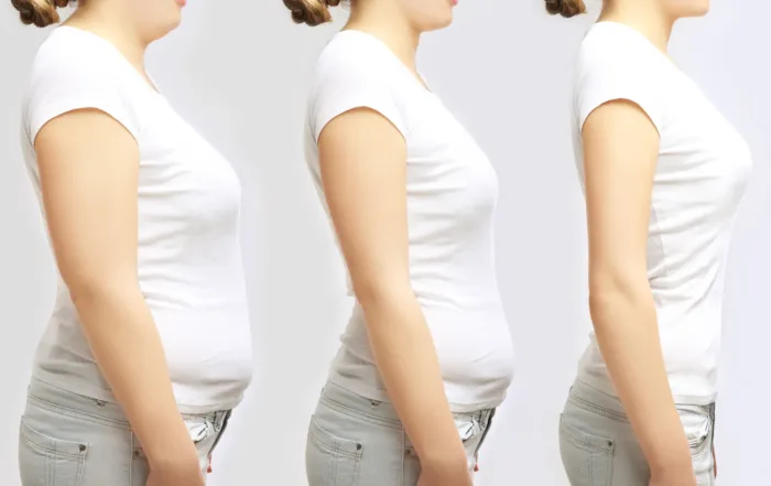 Weight Management by Dr. Terese Taylor