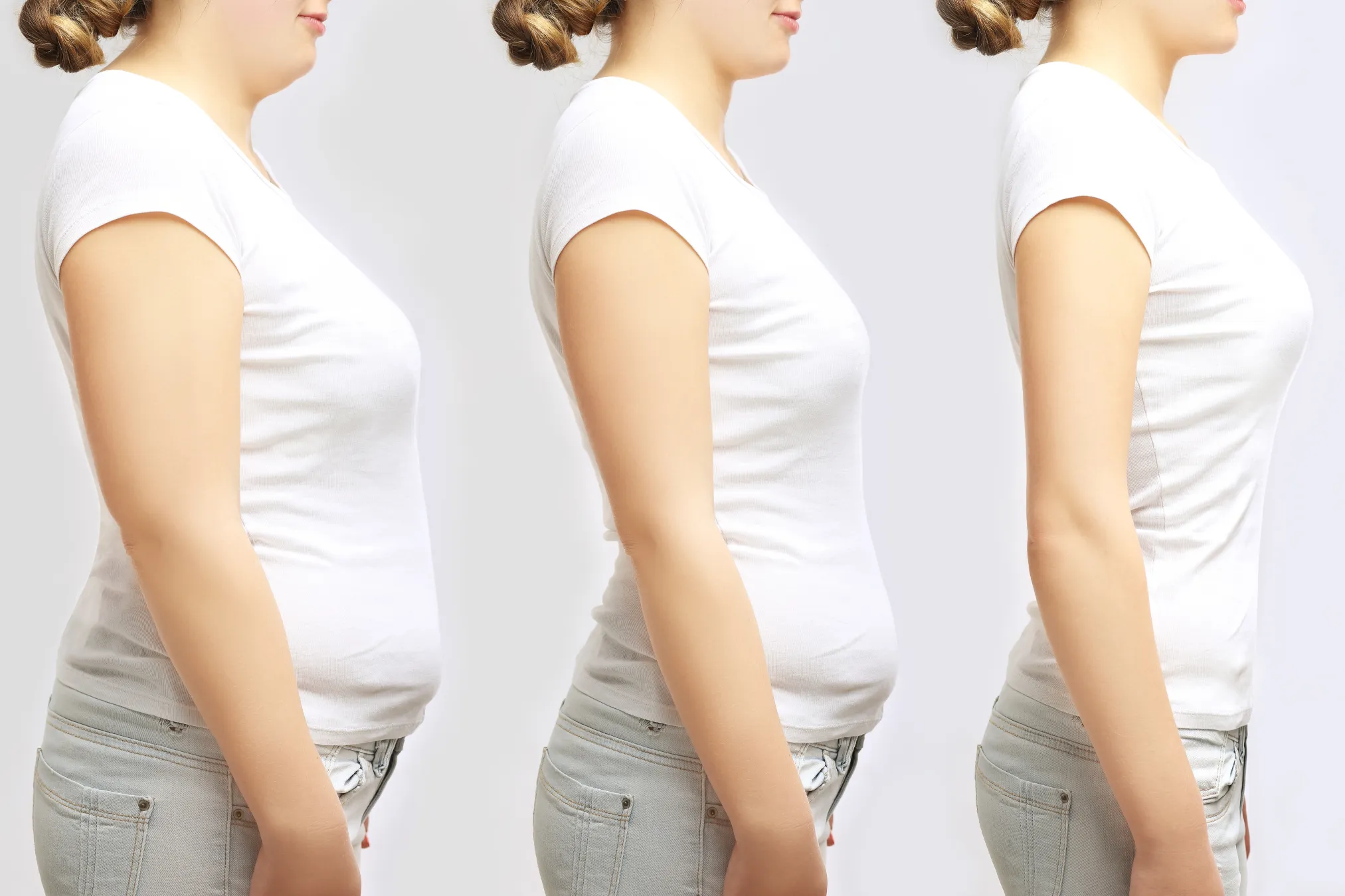 Weight Management by Dr. Terese Taylor